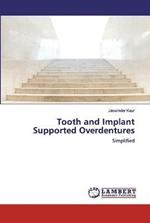 Tooth and Implant Supported Overdentures