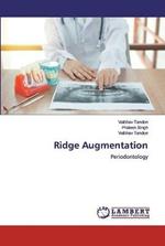 Ridge Augmentation