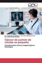 Cancer de pulmon de celulas no pequena