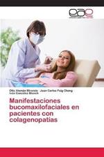 Manifestaciones bucomaxilofaciales en pacientes con colagenopatias