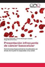 Presentacion infrecuente de cancer basocelular