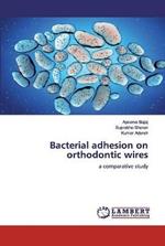 Bacterial adhesion on orthodontic wires