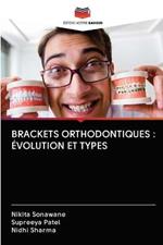 Brackets Orthodontiques: Evolution Et Types