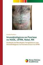 Imunobiologicos na Psoriase no HUOL, UFRN, Natal, RN