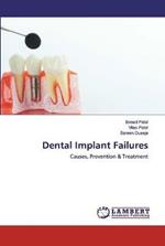 Dental Implant Failures