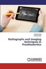 Radiographs and Imaging techniques in Prosthodontics