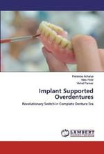 Implant Supported Overdentures