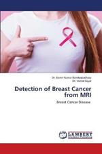 Detection of Breast Cancer from MRI