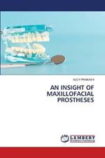 An Insight of Maxillofacial Prostheses