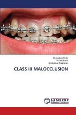 Class III Malocclusion