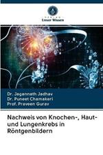 Nachweis von Knochen-, Haut- und Lungenkrebs in Roentgenbildern