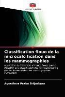 Classification floue de la microcalcification dans les mammographies