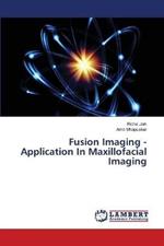 Fusion Imaging - Application In Maxillofacial Imaging