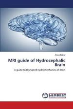 MRI guide of Hydrocephalic Brain