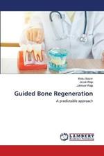 Guided Bone Regeneration