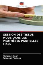 Gestion Des Tissus MOUS Dans Les Protheses Partielles Fixes