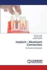 Implant - Abutment Connection