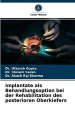 Implantate als Behandlungsoption bei der Rehabilitation des posterioren Oberkiefers