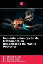 Implante como opcao de tratamento na Reabilitacao da Maxila Posterior