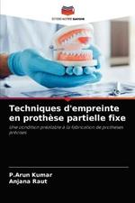 Techniques d'empreinte en prothese partielle fixe