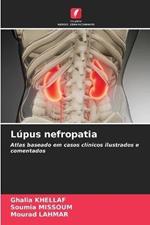 Lupus nefropatia