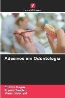 Adesivos em Odontologia