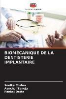Biomecanique de la Dentisterie Implantaire