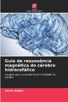 Guia de ressonancia magnetica do cerebro hidrocefalico