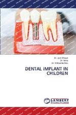 Dental Implant in Children