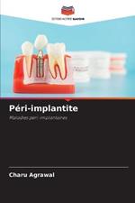 Peri-implantite