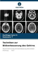 Techniken zur Bildverbesserung des Gehirns