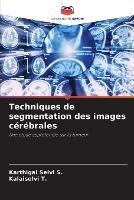 Techniques de segmentation des images cerebrales