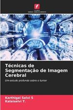 Tecnicas de Segmentacao de Imagem Cerebral