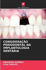 Consideracao Periodontal Na Implantologia Dentaria