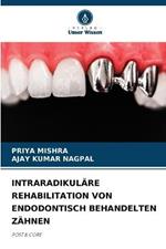 Intraradikulare Rehabilitation Von Endodontisch Behandelten Zahnen