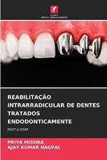 Reabilitacao Intrarradicular de Dentes Tratados Endodonticamente