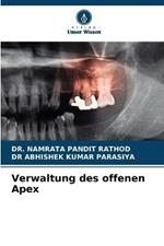 Verwaltung des offenen Apex