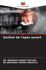 Gestion de l'apex ouvert