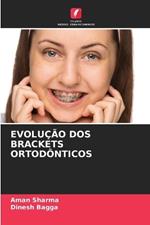 Evolução DOS Brackets Ortodônticos