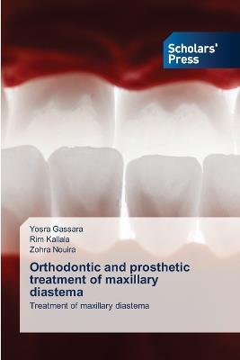 Orthodontic and prosthetic treatment of maxillary diastema - Yosra Gassara,Rim Kallala,Zohra Nouira - cover