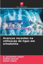 Avanços recentes na utilização de ligas em ortodontia