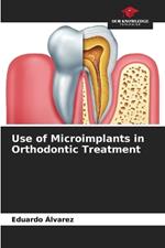 Use of Microimplants in Orthodontic Treatment