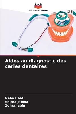 Aides au diagnostic des caries dentaires - Neha Bhati,Shipra Jaidka,Zohra Jabin - cover