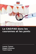 La CAO/FAO dans les couronnes et les ponts