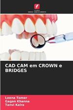 CAD CAM em CROWN e BRIDGES