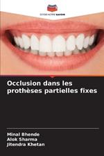 Occlusion dans les proth?ses partielles fixes