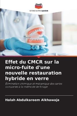 Effet du CMCR sur la micro-fuite d'une nouvelle restauration hybride en verre - Halah Abdulkareem Alkhawaja - cover