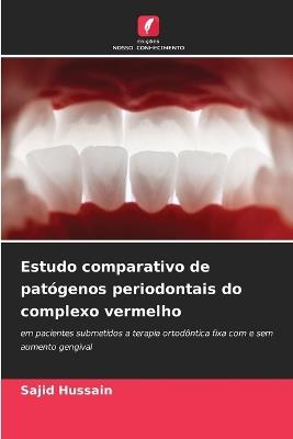 Estudo comparativo de pat?genos periodontais do complexo vermelho - Sajid Hussain - cover