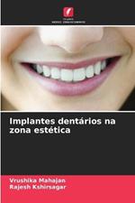 Implantes dent?rios na zona est?tica