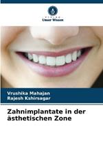 Zahnimplantate in der ?sthetischen Zone